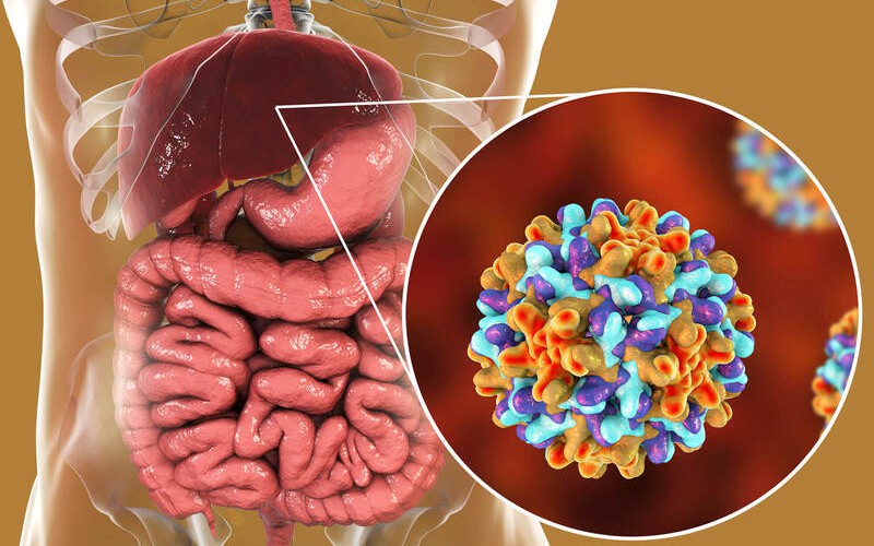 Xơ gan mất bù: Nguyên nhân, triệu chứng, cách điều trị và phòng bệnh