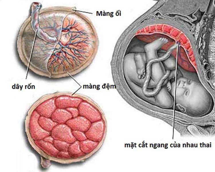 Nhau bong non: Nguyên nhân, triệu chứng, cách điều trị và phòng ngừa- Ảnh 1.