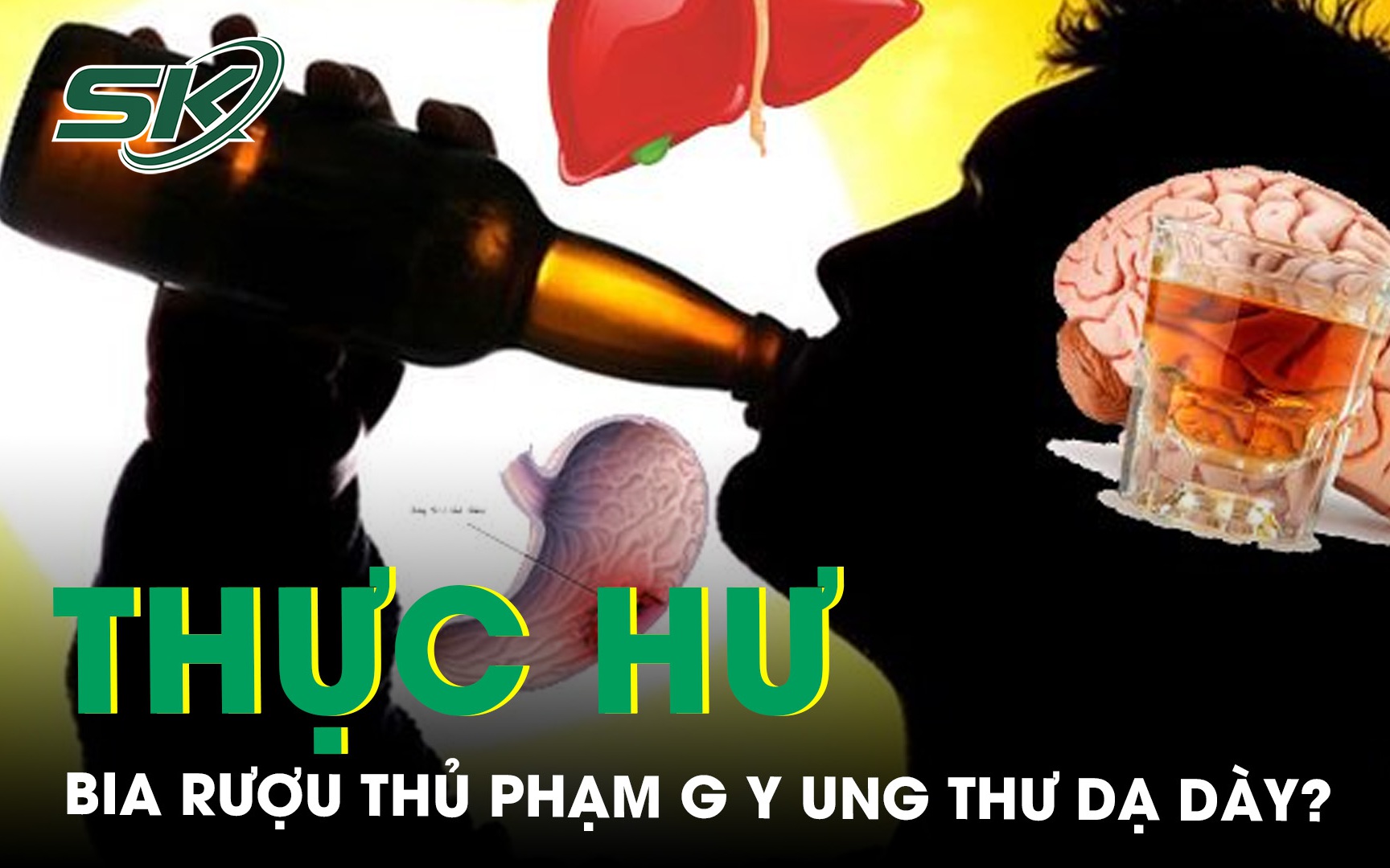 Thực hư bia rượu thủ phạm gây ung thư dạ dày?