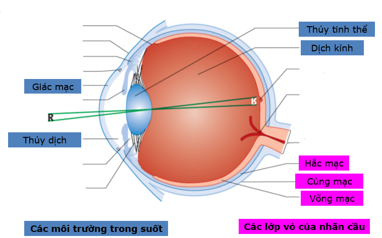 4 bệnh lý gây mù mắt ở trẻ và cách phòng tránh- Ảnh 1.