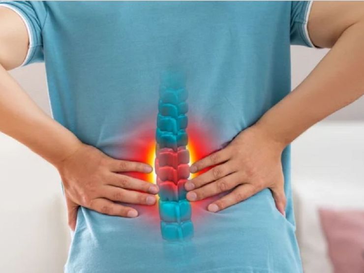 Gai cột sống có nguy hiểm không?- Ảnh 2. Gai cột sống có nguy hiểm không?- Ảnh 2.