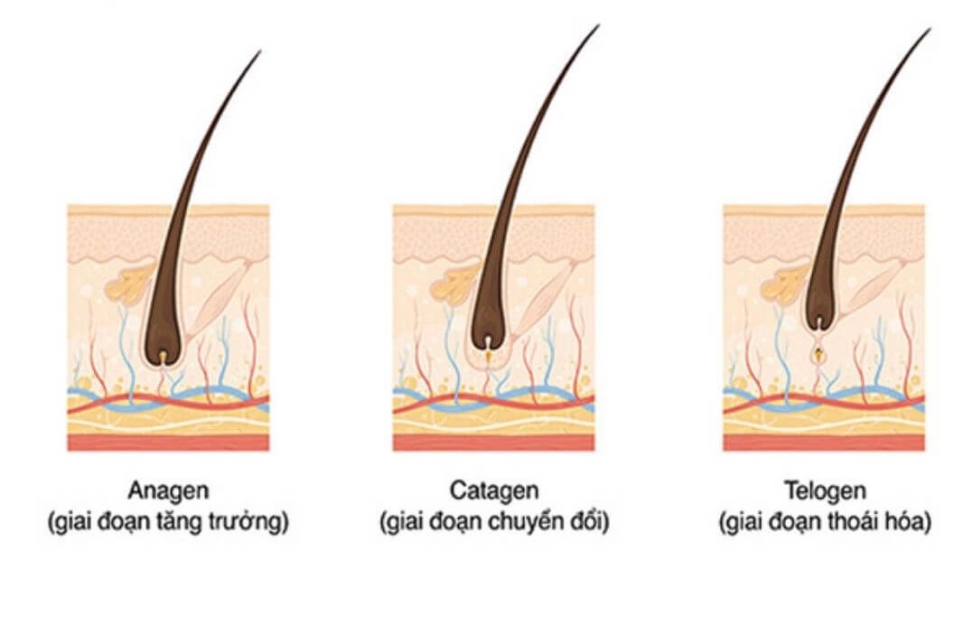 Cách phân biệt rụng tóc sinh lý và rụng tóc bệnh lý- Ảnh 1.