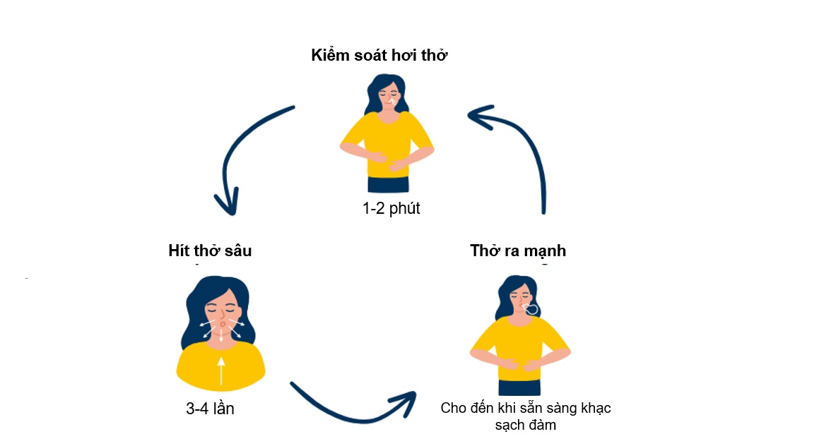 Bài tập tốt cho người bệnh giãn phế quản- Ảnh 2.