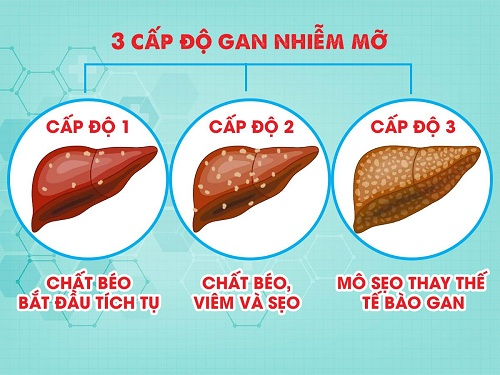 Cân bằng chuyển hóa – bảo vệ sức khỏe của gan- Ảnh 2.