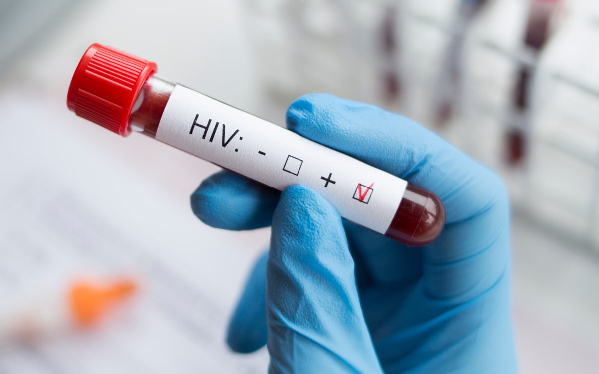 4 giải pháp thực hiện mục tiêu xét nghiệm HIV đến năm 2030