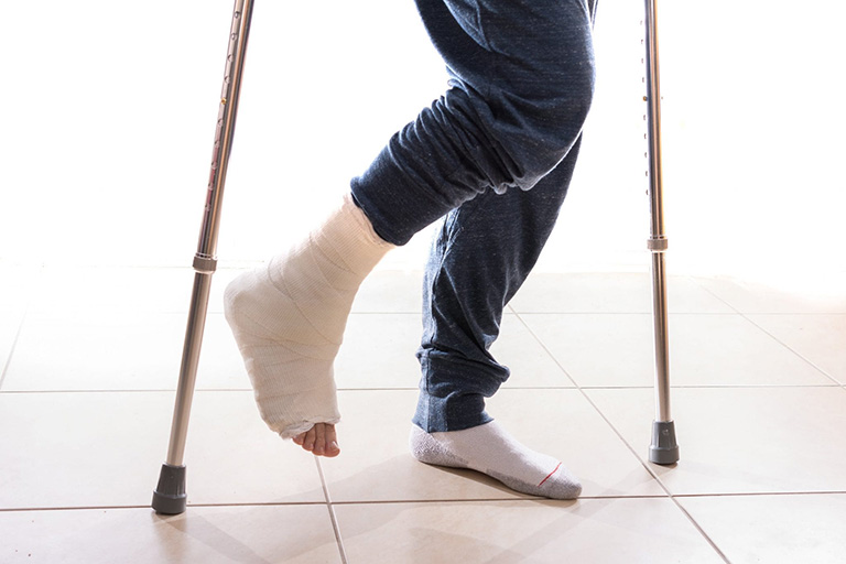 Lưu ý khi phục hồi chức năng sau gãy xương- Ảnh 2.