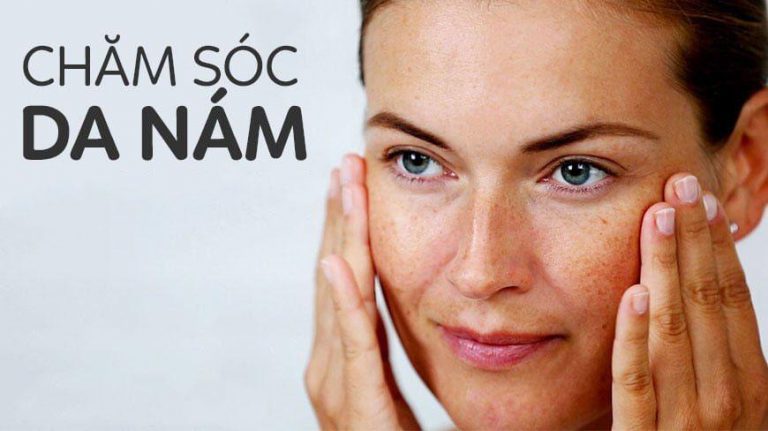 Sử dụng retinol trị nám cần lưu ý gì?- Ảnh 1.