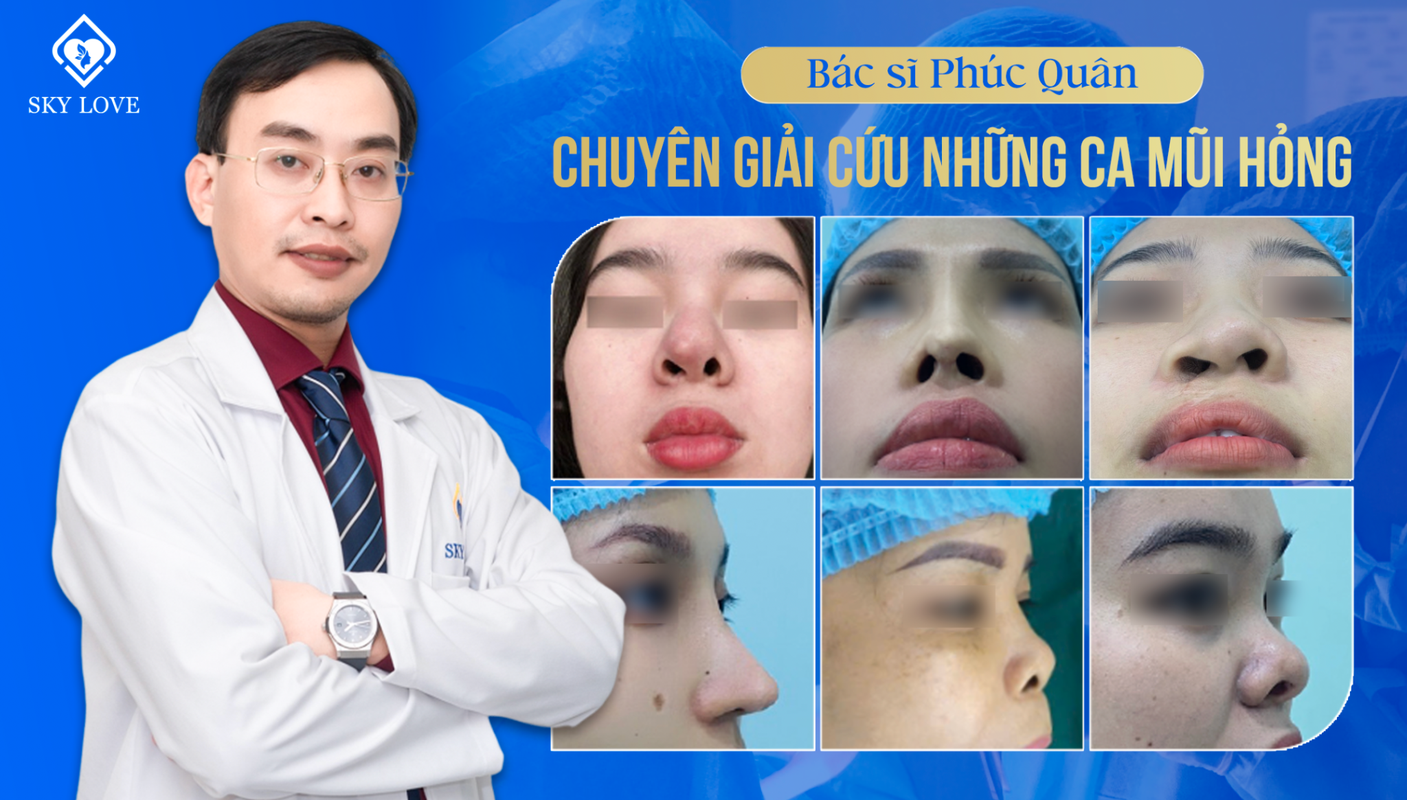 Người bác sĩ mát tay "cứu tinh" của những ca mũi hỏng- Ảnh 1.