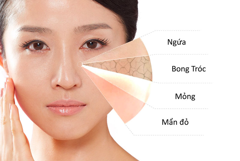 Da nhạy cảm chăm sóc như nào vào mùa hanh khô