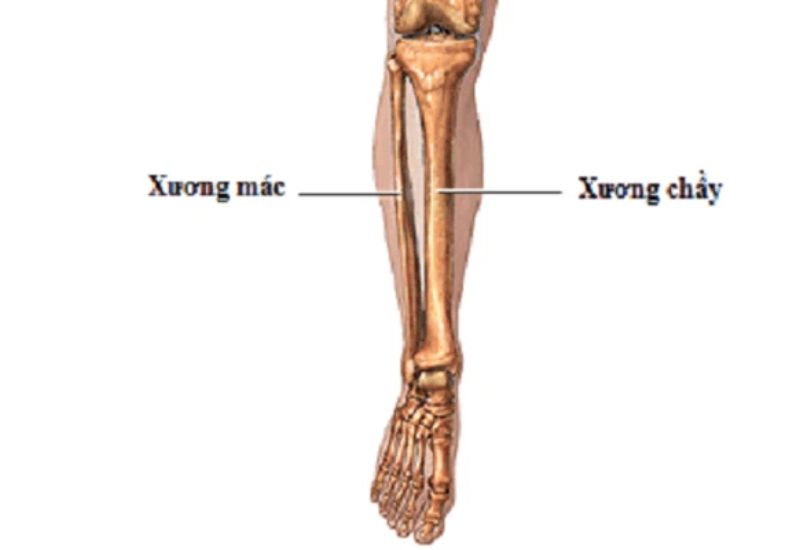 Chế độ ăn cho người bị gãy xương mác- Ảnh 1.