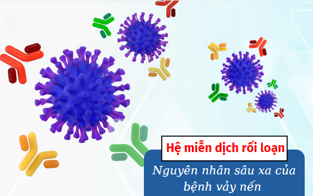 Vảy nến khó kiểm soát, dễ tái phát - Hiểu nguyên nhân sẽ biết cách xử lý- Ảnh 1.