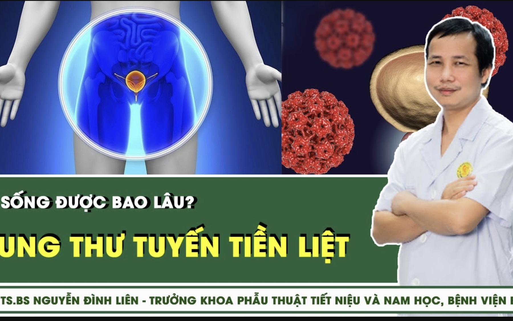 Mắc ung thư tuyến tiền liệt sống được bao lâu?