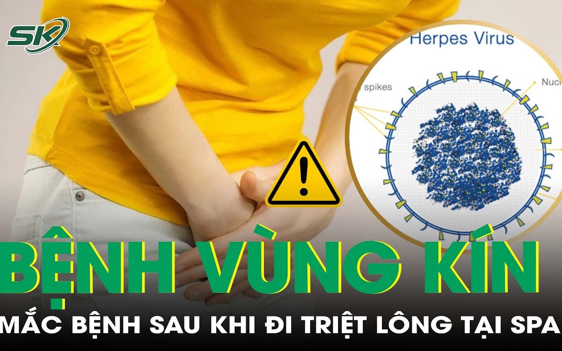 Phụ nữ có nên triệt lông vùng kín không?- Ảnh 3. Lây bệnh khó nói cho chồng sau khi đi triệt lông vùng kín