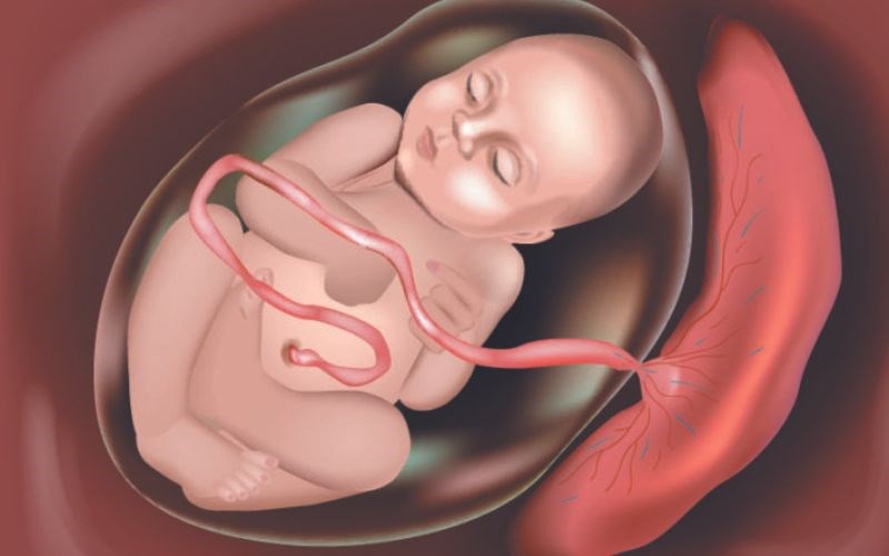 Nhau cài răng lược, nỗi ám ảnh khi mang thai