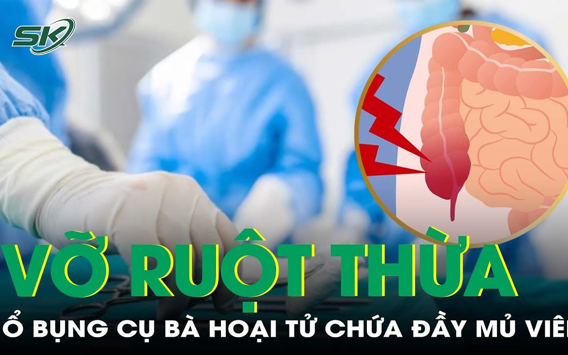 Vỡ ruột thừa suốt 10 ngày, ổ bụng cụ bà hoại tử chứa đầy mủ và dịch viêm