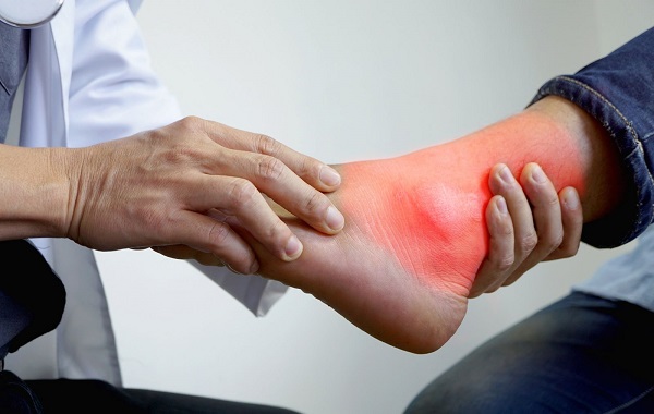 Gout cần được điều trị ngay lập tức sau khi phát hiện bệnh.