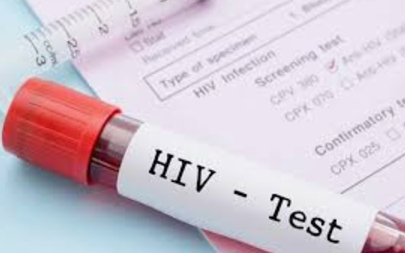 Vai trò của chẩn đoán phân tử trong theo dõi điều trị HIV- Ảnh 1.