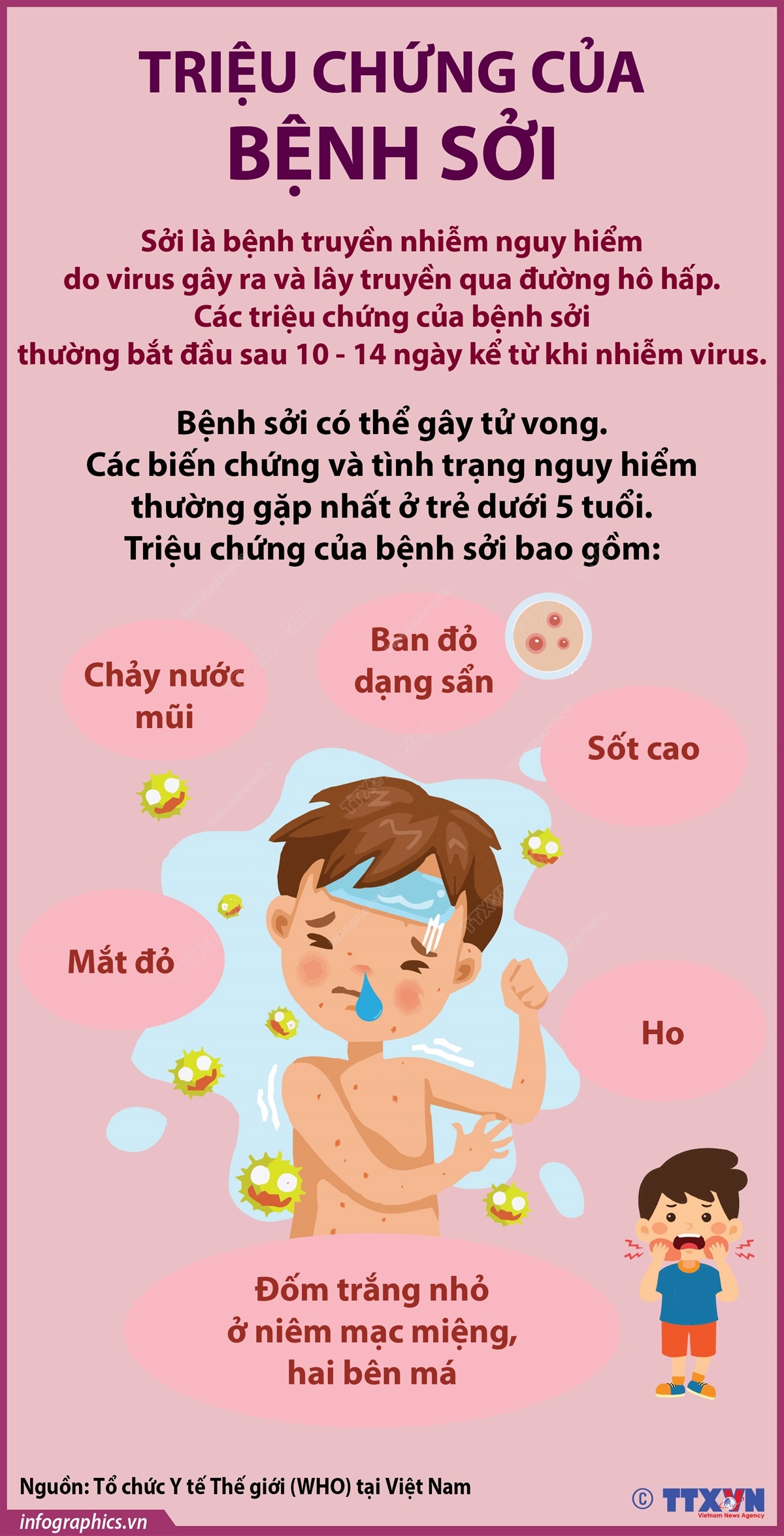 Infographic: Phòng ngừa bệnh sởi- Ảnh 1.