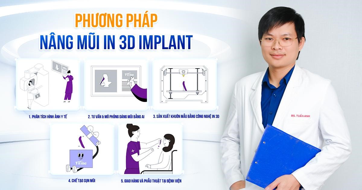 Bác sĩ Nguyễn Tuấn Anh chia sẻ về ứng dụng công nghệ nâng mũi In 3D Implant- Ảnh 1.