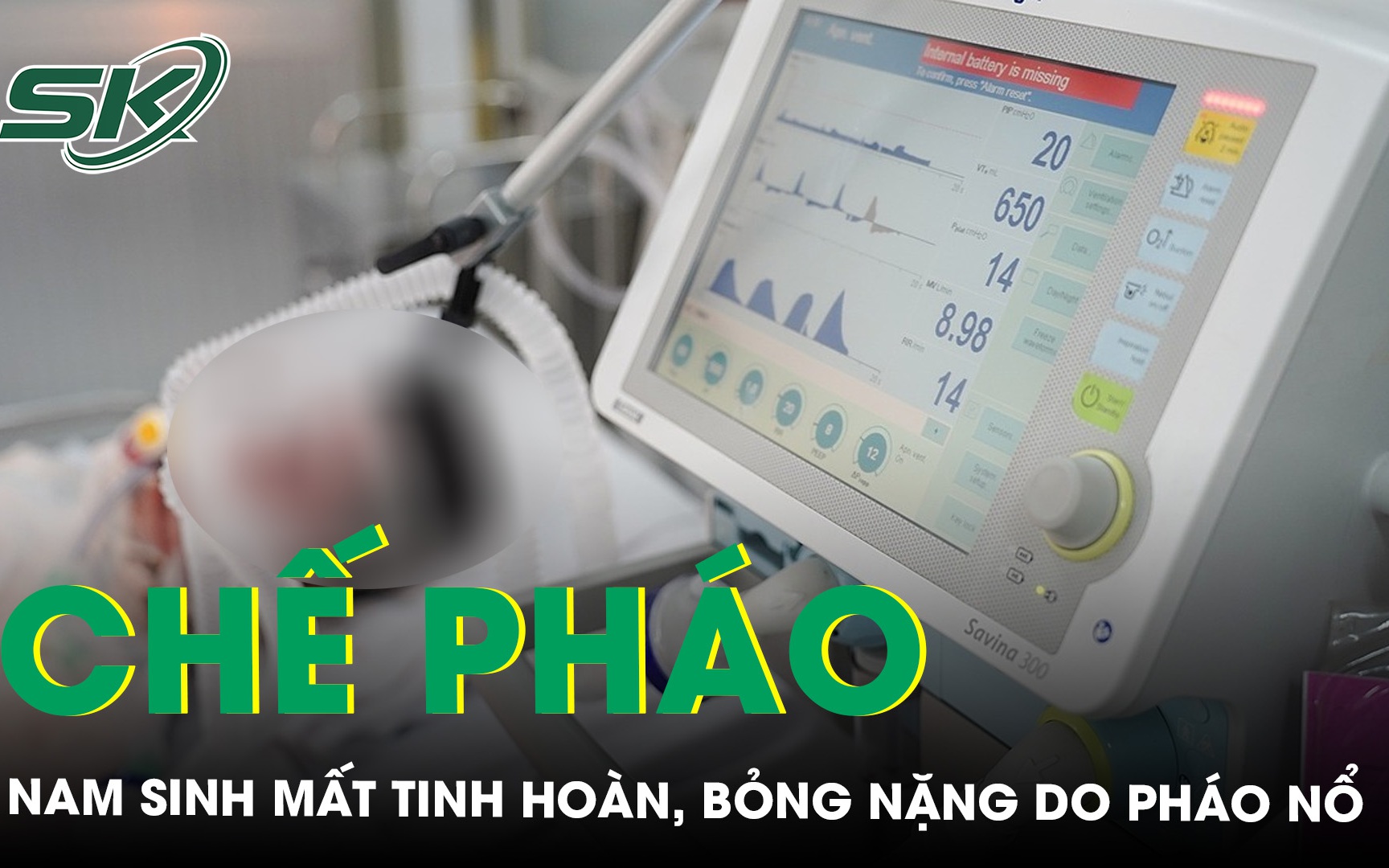 Mất tinh hoàn, bỏng nặng do pháo tự chế phát nổ