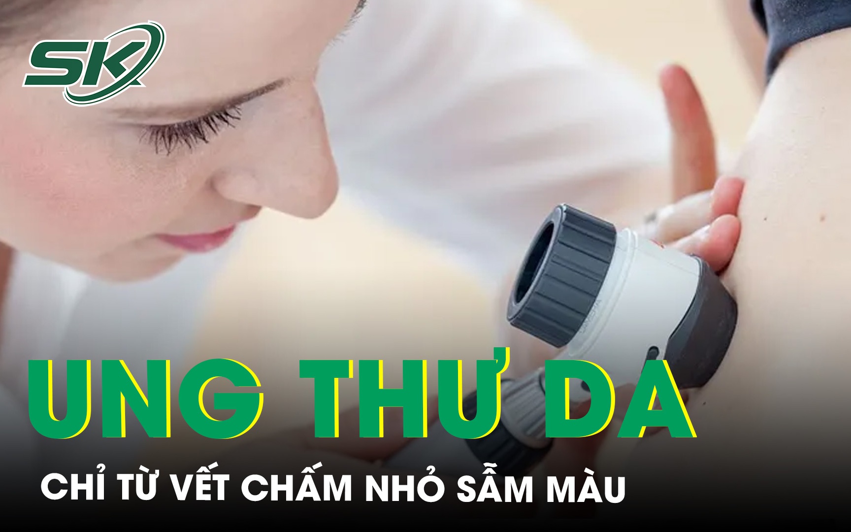 Bất ngờ phát hiện ung thư tế bào vảy chỉ từ vết chấm nhỏ sẫm màu