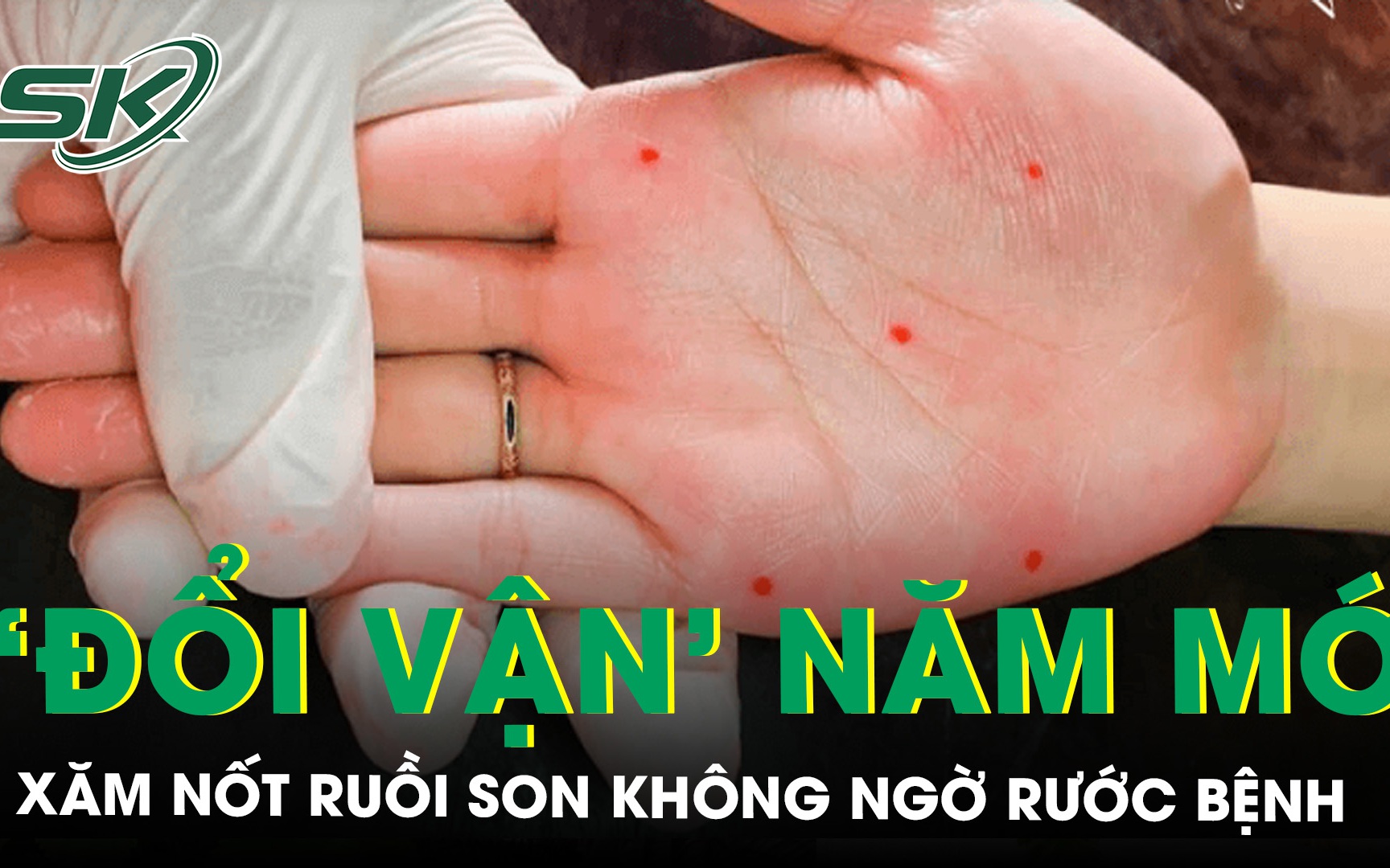 Xăm nốt ruồi son 