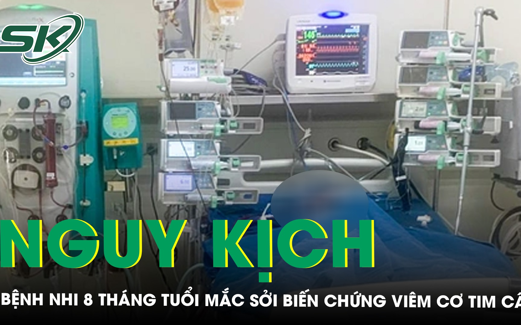 Trẻ 8 tháng tuổi mắc sởi biến chứng viêm cơ tim cấp