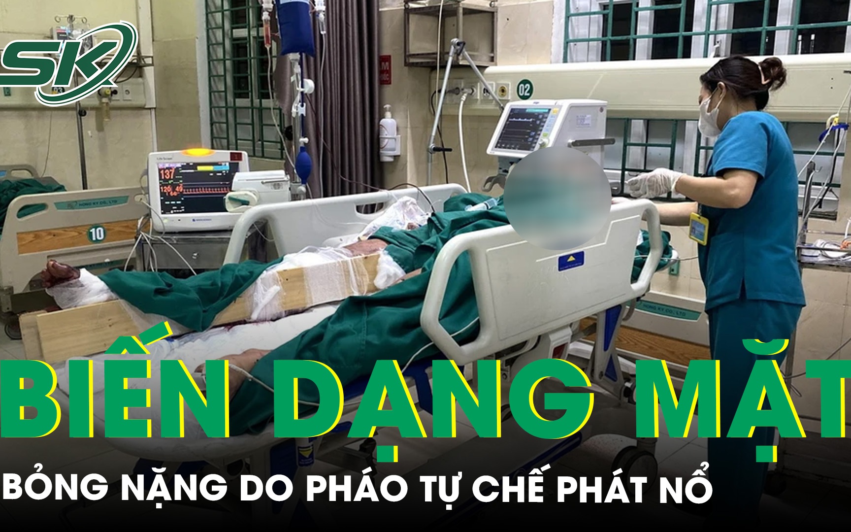 Thanh niên biến dạng mặt, bỏng nặng do pháo tự chế phát nổ 