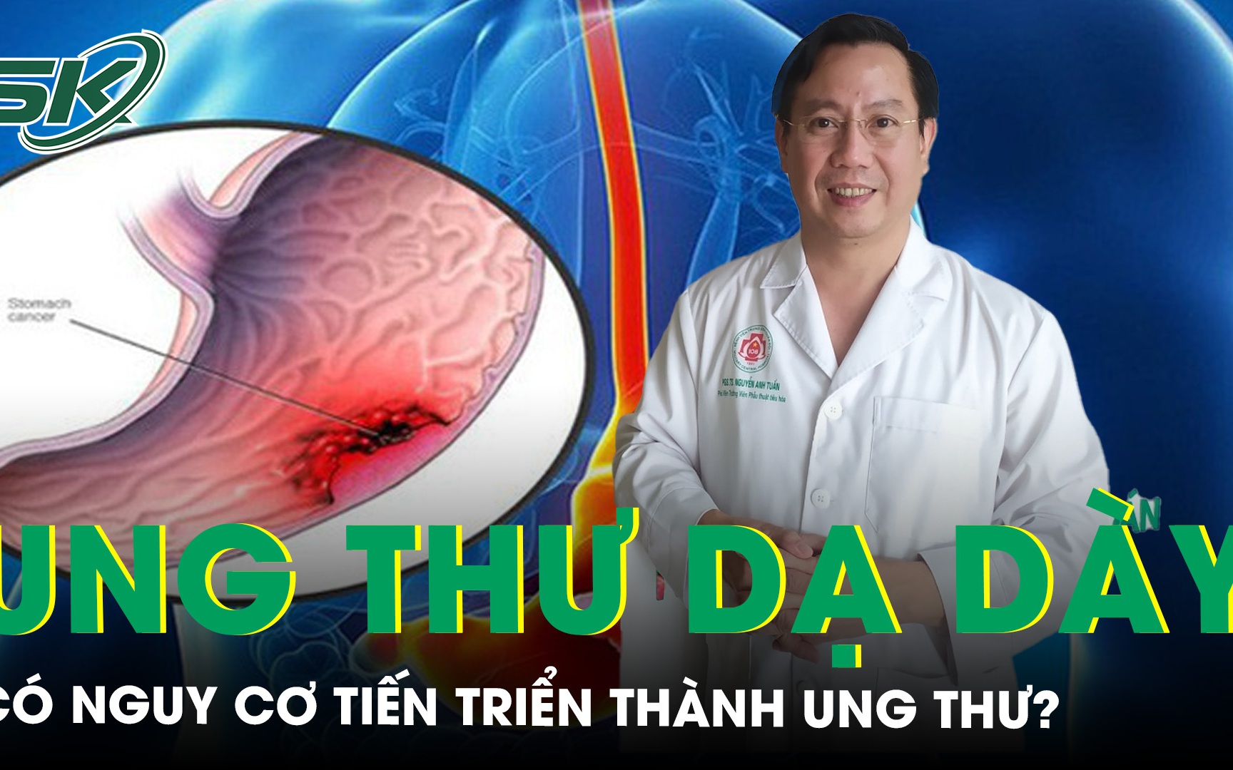 Viêm loét dạ dày có nguy cơ tiến triển thành ung thư không? 