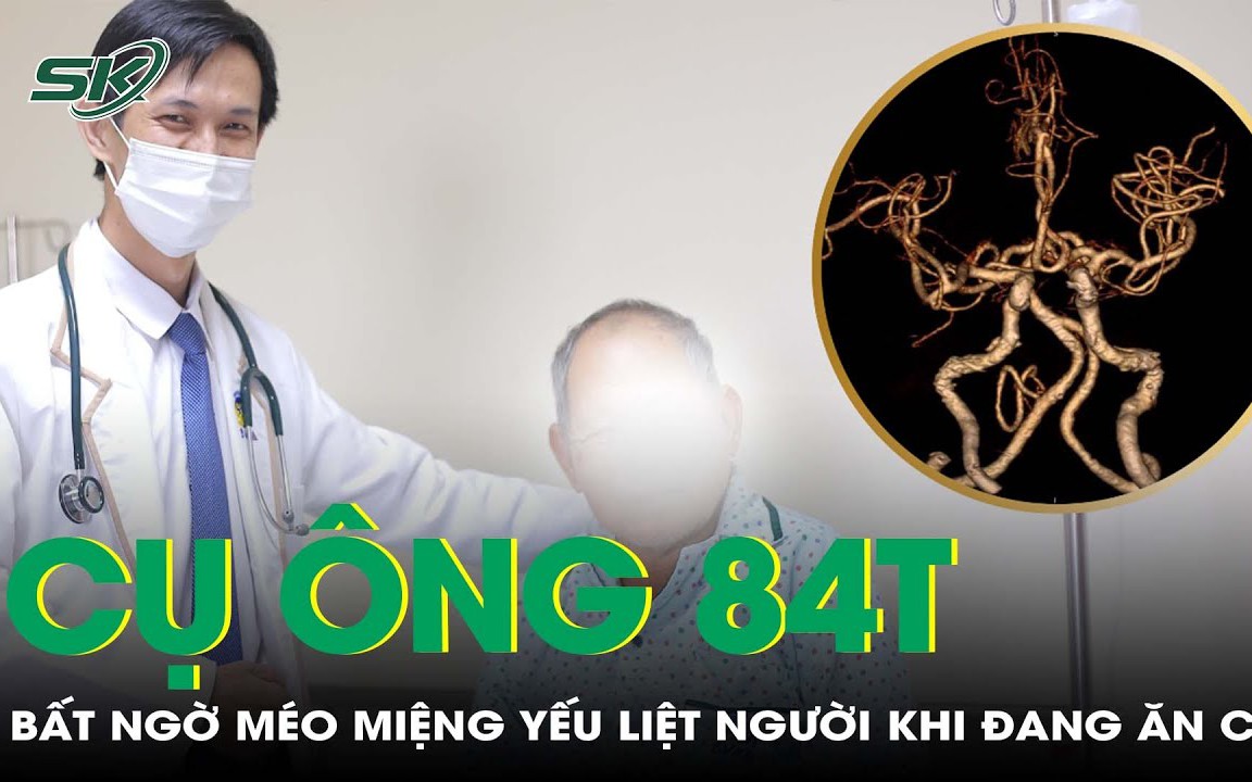 Cấp cứu thành công cụ ông 84 tuổi đột quỵ khi đang ăn cơm