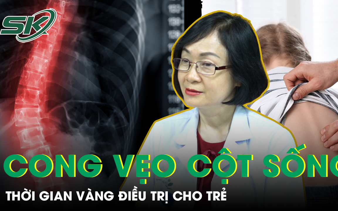 Nên điều trị cong vẹo cột sống cho trẻ vào thời điểm nào?