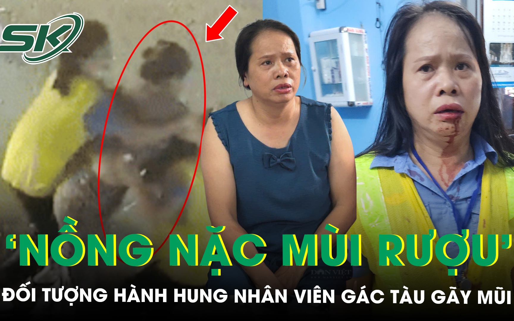 Nữ nhân viên gác tàu bị đánh gãy mũi kể ‘đối tượng nồng nặc mùi rượu, liên tục chửi bới’