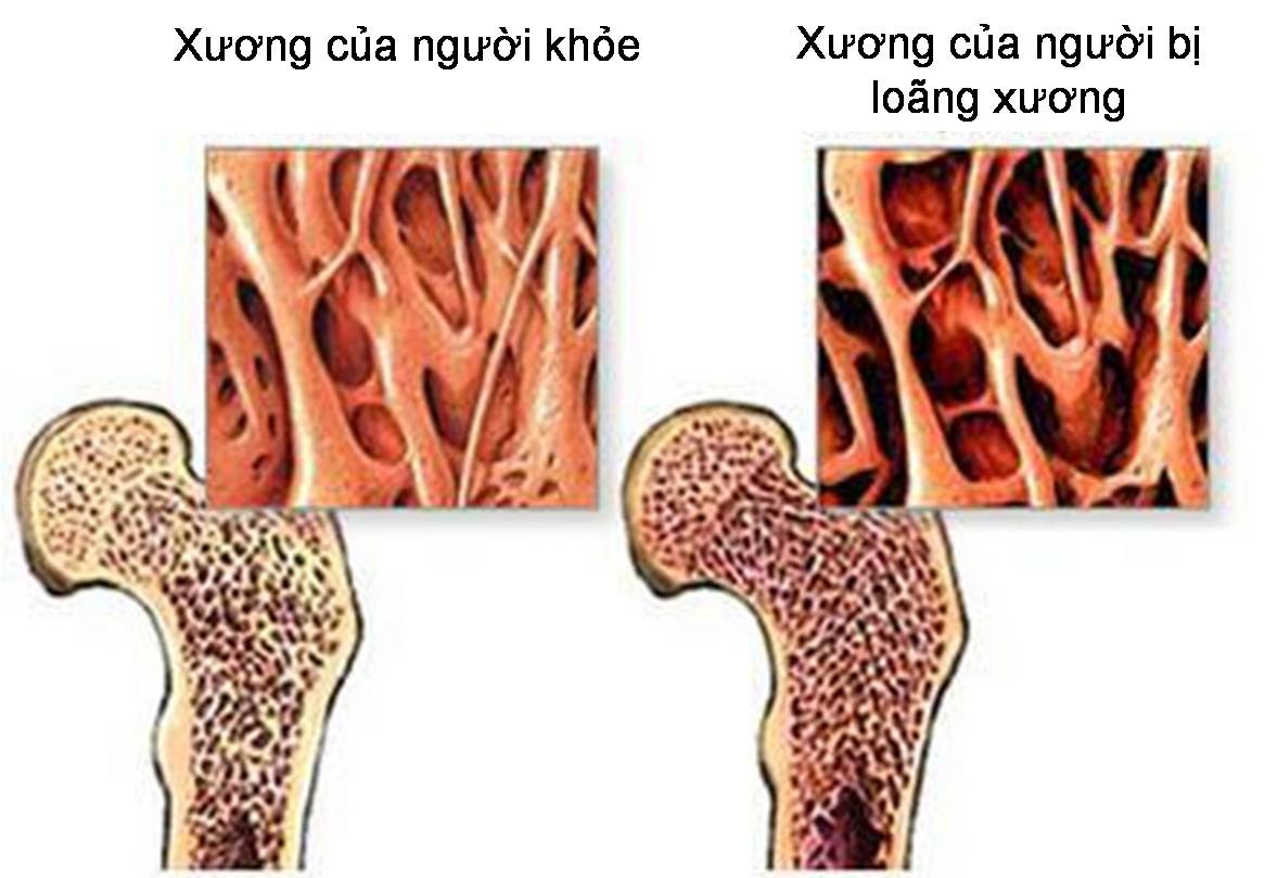 10 lợi ích khi uống nước hạt chia mật ong mỗi ngày- Ảnh 2.