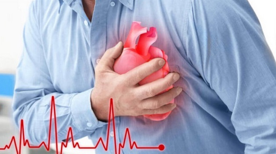 Dấu hiệu sớm cảnh báo nhồi máu cơ tim cấp- Ảnh 2. Dấu hiệu sớm cảnh báo nhồi máu cơ tim cấp- Ảnh 2.