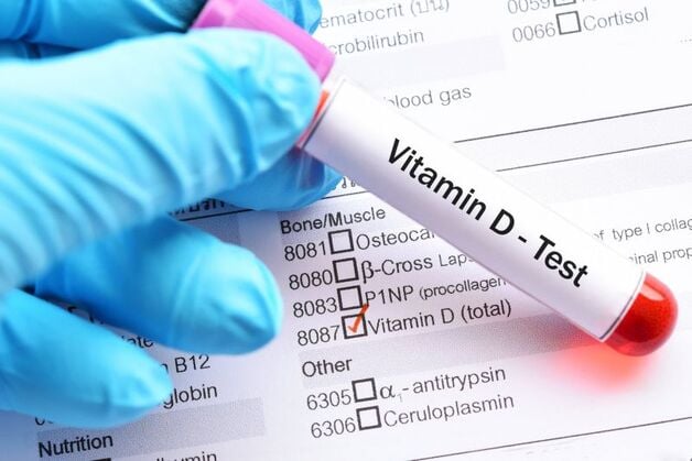 Xét nghiệm định lượng Vitamin D3 (25OH vitamin D) có ý nghĩa gì?