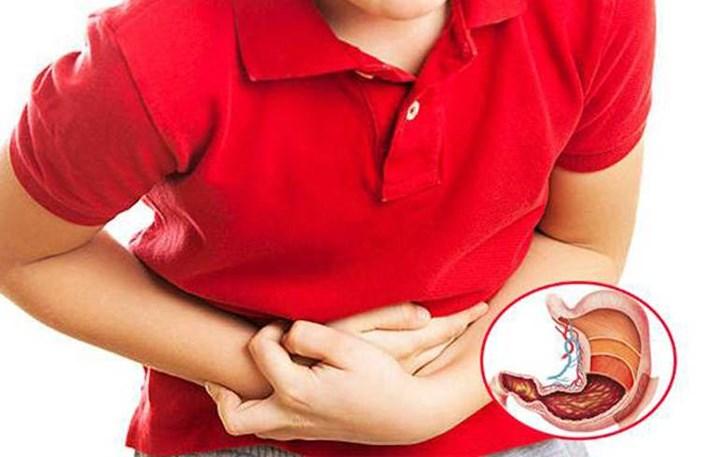 Căng thẳng, stress có gây viêm loét dạ dày không? - Ảnh 1. Căng thẳng, stress có gây viêm loét dạ dày không? - Ảnh 1.