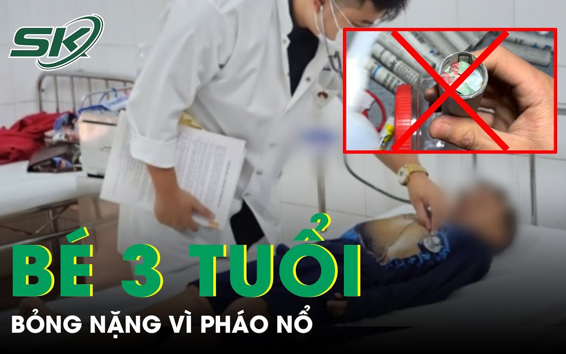 Nhiều trẻ cấp cứu bỏng nặng vì pháo nổ