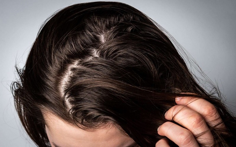 Cách gội đầu cho tóc bết khi thời tiết nồm ẩm