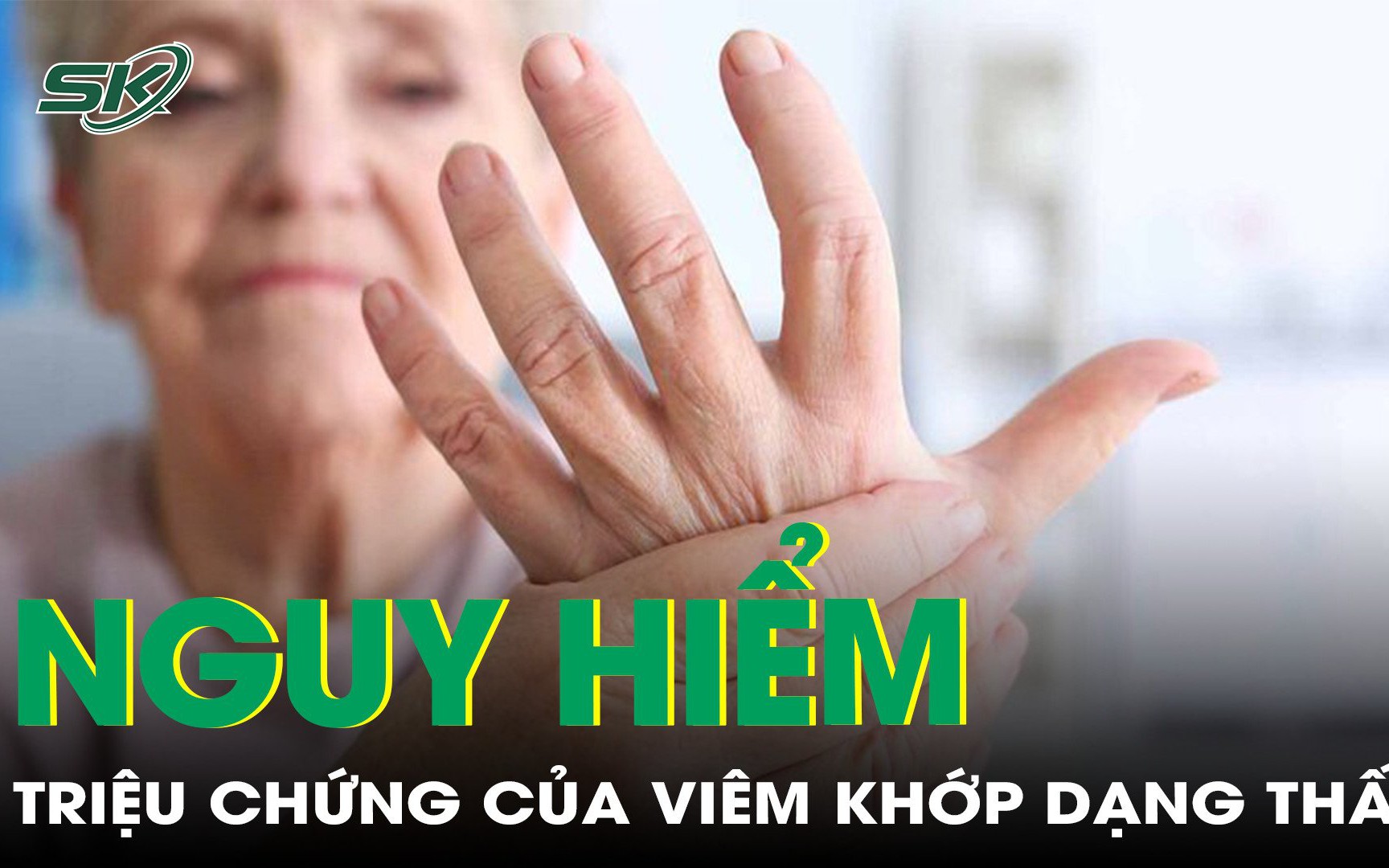 Các triệu chứng nguy hiểm của viêm khớp dạng thấp