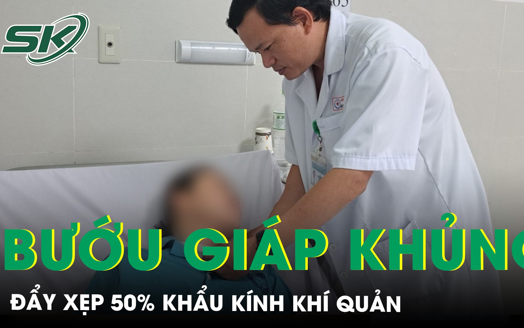 Chủ quan với u lành tuyến giáp, sau 10 năm phát triển bướu khủng chèn ép khí quản 