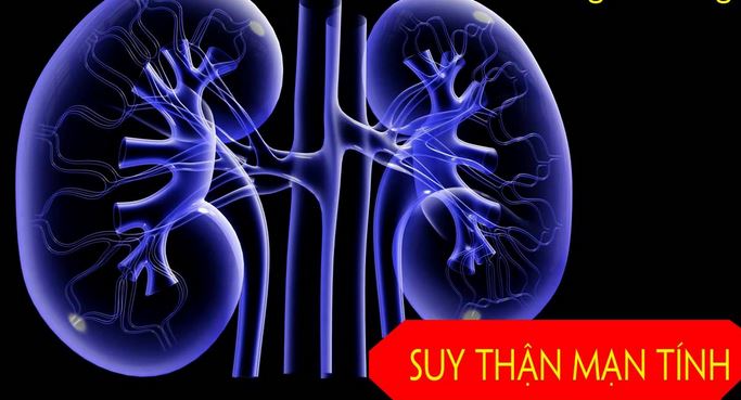 Các phương pháp điều trị suy thận mạn tính- Ảnh 1. Các phương pháp điều trị suy thận mạn tính- Ảnh 1.