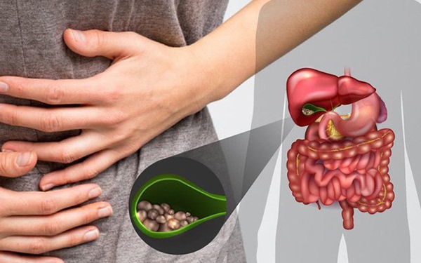 Những yếu tố làm tăng nguy cơ mắc sỏi túi mật