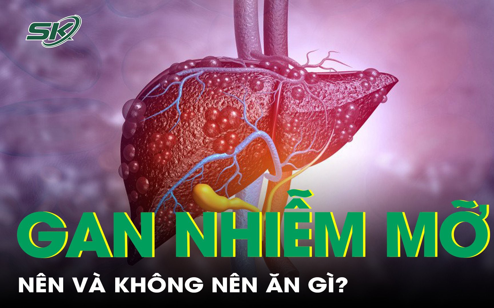 Chế độ ăn phù hợp cho người bị gan nhiễm mỡ