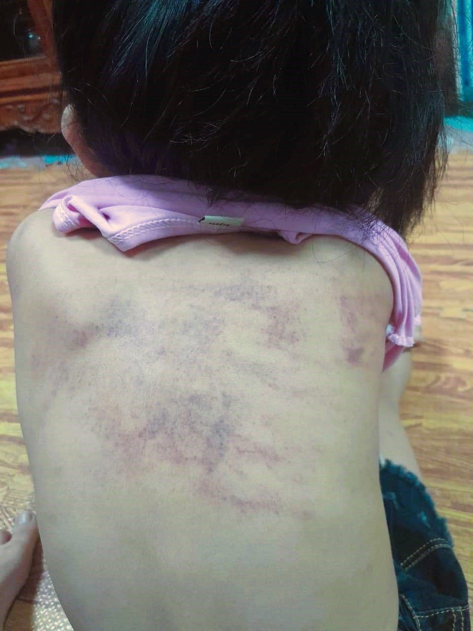 Bé gái 5 tuổi nghi bị bạo hành ở trường, Chủ tịch TP. Hải Phòng yêu cầu làm rõ- Ảnh 5.