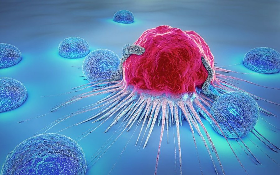 Phân biệt khối u lành tính và khối u ung thư