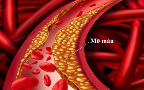 Mỡ máu bao nhiêu là cao, nên ăn uống gì?
