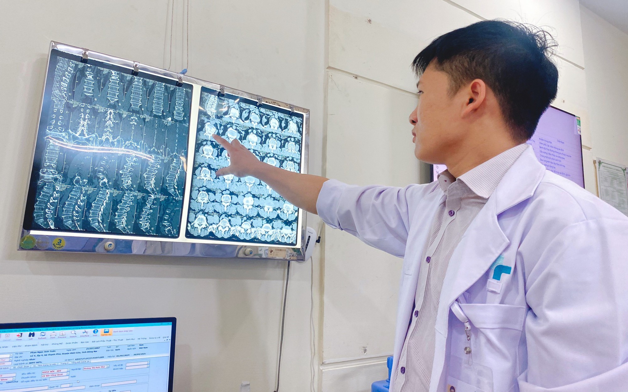Phẫu thuật bắt vít qua da điều trị chấn thương cột sống cho người bệnh bị tai nạn sinh hoạt