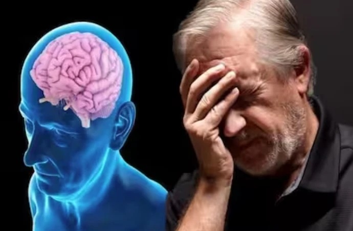 Thêm liệu pháp mới trị bệnh Alzheimer- Ảnh 1.