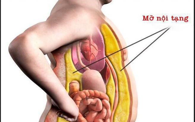 Mỡ nội tạng có hại thế nào với sức khỏe?