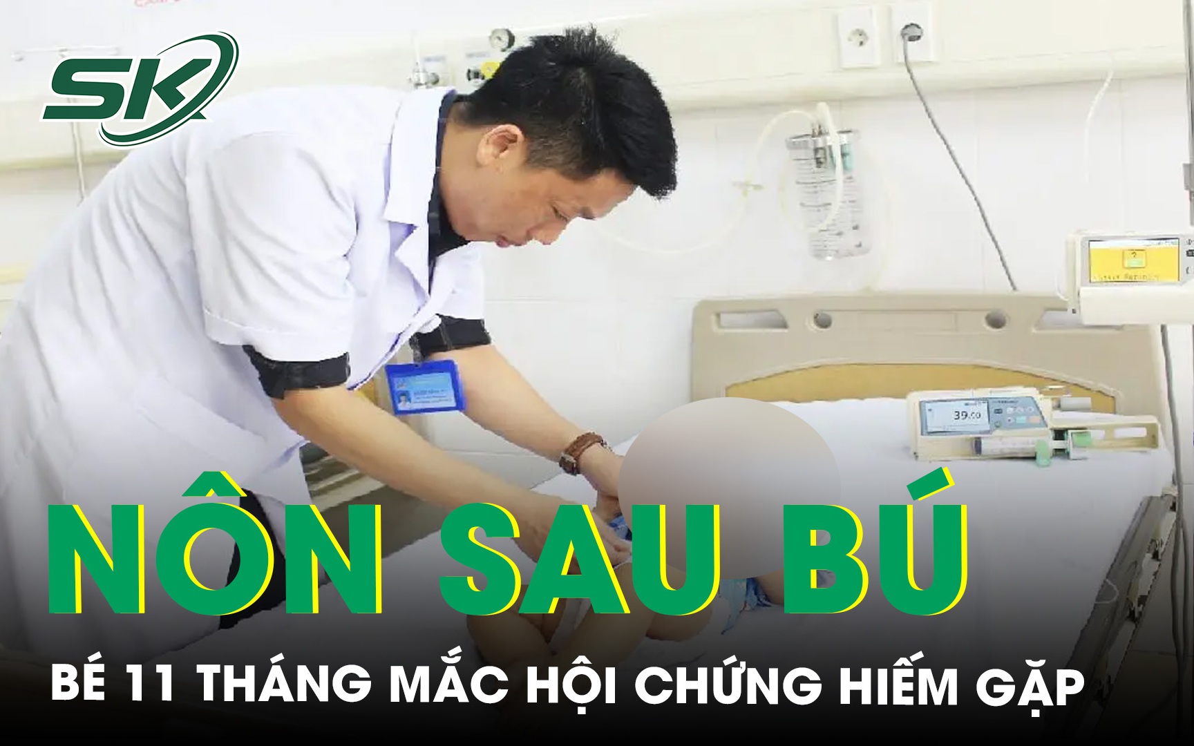 Nôn hoàn toàn sau bú, bé 11 tháng tuổi mắc chứng tắc tá tràng bẩm sinh hiếm gặp 